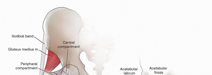 Hip Synovial Disorders: When is Loose Body Removal Necessary?