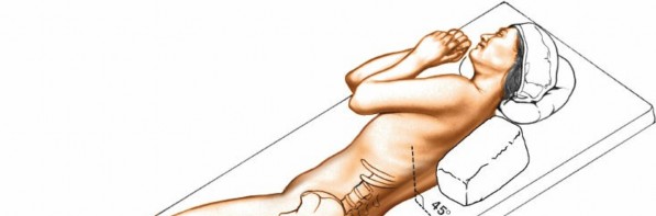 Illustration 130 for Approach to the Lumbar Spine: Mastering Techniques & Anatomy