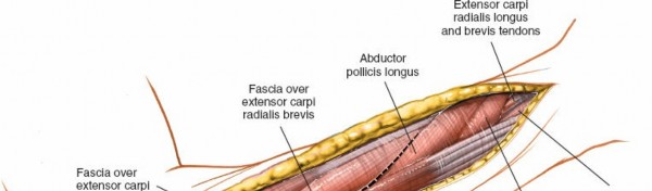 Illustration 7 for Posterior Radius: Expert Tips for Brevis and the Extensor Side