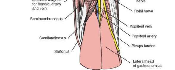 Illustration 125 for Optimal Femoral Approaches: Mastering the Lateral Intermuscular Septum