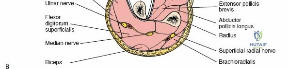 Clinical Image