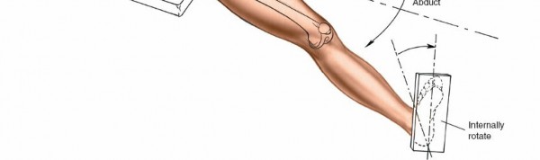 Illustration 3 for Optimal Femoral Approaches: Mastering the Lateral Intermuscular Septum