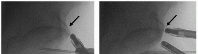 Illustration 22 for Beyond Knee Surg: Hip Arthroscopy for Sports Injuries