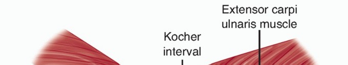 Illustration 23 for Radial Head & Neck Fractures: Mastering ORIF for Best Results