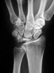 صورة طبية: دليل الأستاذ الدكتور محمد هطيف الشامل لأمراض وإصابات اليد والمعصم في صنعاء