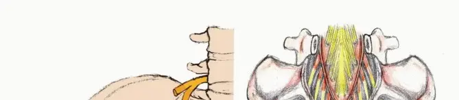 جراحة أورام العجز: الحفاظ على وظائف الأمعاء والمثانة مع الأستاذ الدكتور محمد هطيف في صنعاء