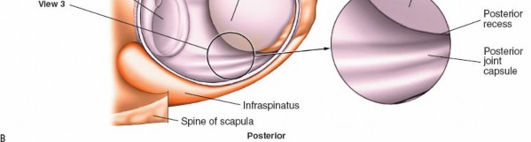 Illustration 233 for Essential Guide: Mastering Every Approach to the Shoulder