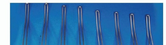 Illustration 4 for Duchenne Muscular Dystrophy: Is Spinal Fusion the Answer?