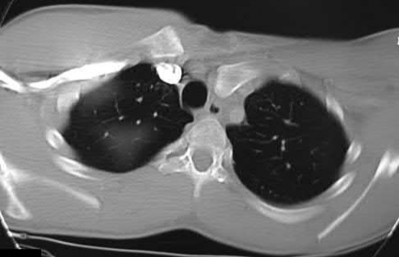 Illustration 89 for OrthoCash: Trauma MCQs & Cases for a yearold woman