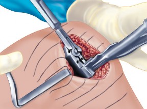 وصف طبي دقيق للمريض