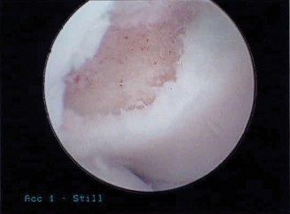Illustration 7 for Solve Orthopedic Cases: Extensor Carpi Radialis Brevis & Elbow Pain