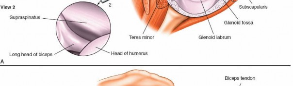 Illustration 227 for Essential Guide: Mastering Every Approach to the Shoulder