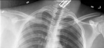 Illustration 43 for OrthoCash: Trauma MCQs & Cases for a yearold woman