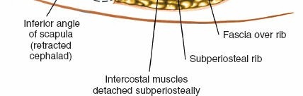 Illustration 316 for Approach to the Lumbar Spine: Mastering Techniques & Anatomy