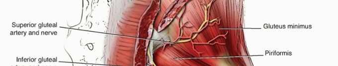 Illustration 2 for Total Hip Arthroplasty: Journey to Preventing Complications