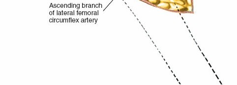 Illustration 40 for Unlocking Every Aspect of the Hip's Surgical Approaches
