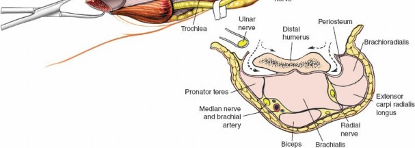 Illustration 14 for Mastering Elbow Approaches: Applied Surgical Anatomy for Precision