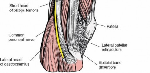 Illustration 90 for Optimal Femoral Approaches: Mastering the Lateral Intermuscular Septum