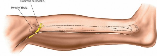 Illustration 89 for Surgical Access: Mastering the Tibia's Surface & Fibula Approaches