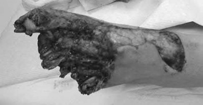 Illustration 159 for OrthoCash: Trauma MCQs & Cases for a yearold woman