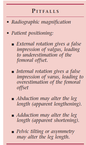 Illustration 2 for Templating for Primary THA: Optimize Outcomes & Avoid Pitfalls