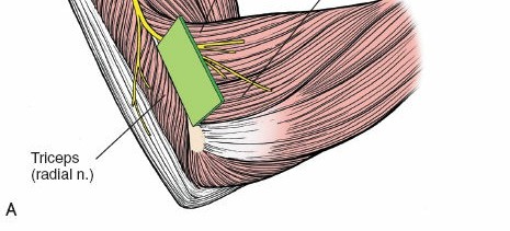 Illustration 76 for Mastering the Approach to the Distal Humerus: Safety & Skills
