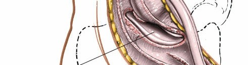 Illustration 127 for Optimized Approaches to the Dorsum of the Foot & Ankle