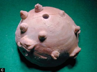 Illustration 11 for Optimizing Acetabular Component Cementation for Superior Outcomes