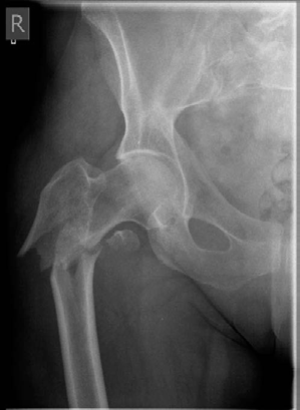 Illustration 5 for Lower Limb Trauma: Decipher Anteroposterior (AP) Figure for Exams