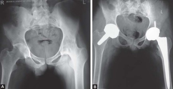 Illustration 31 for Unlock Movement: Arthroplasty for Bony Ankylosis Solutions