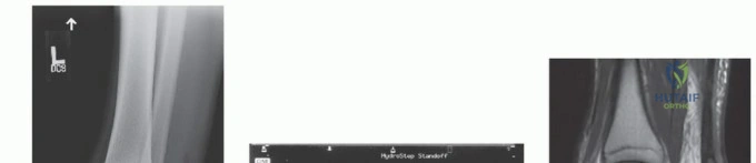 FRCS Mock Exam 2: Clinical Reasoning