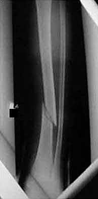 Illustration 146 for OrthoCash: Trauma MCQs & Cases for a yearold woman