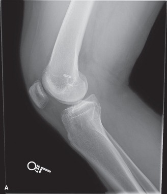 Illustration 8 for Solve Sports Medicine Cases: Uncover Why the Correct Answer Is E