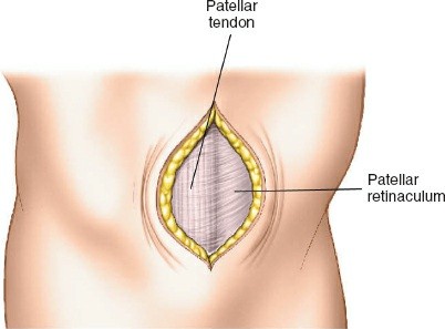 Illustration 123 for Surgical Access: Mastering the Tibia's Surface & Fibula Approaches