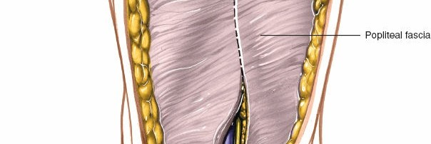 Illustration 178 for Mastering Knee Approaches: Spotlight on Superficial Medial Ligament