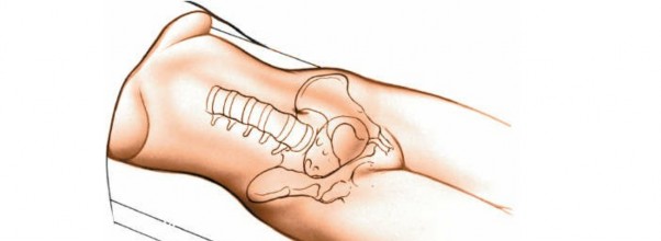 Illustration 51 for Approach to the Lumbar Spine: Mastering Techniques & Anatomy