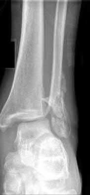 Illustration 93 for OrthoCash: Trauma MCQs & Cases for a yearold woman