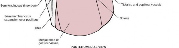 Illustration 129 for Mastering Knee Approaches: Spotlight on Superficial Medial Ligament