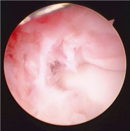 Illustration 46 for First Metatarsal Surgery: Expert Solutions for Foot & Ankle Pain