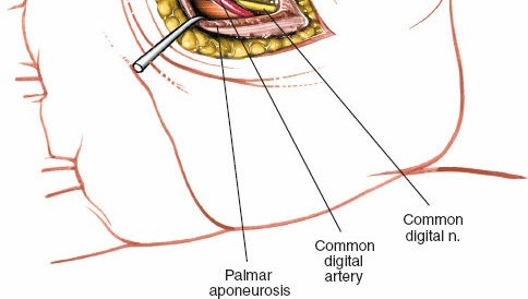 Illustration 235 for Essential Surgical Approaches: Uncover Every Aspect of the Wrist