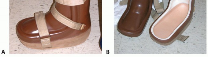 Illustration 2 for Regain Mobility: Surgical Solutions for Charcot Foot Arthropathy