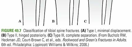 Illustration 32 for Master Pediatric Femoral Shaft & Knee Fractures: Interactive Module