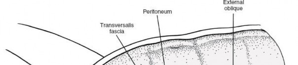 Illustration 28 for Master the Anterolateral Retroperitoneal Approach to Lumbar Spine