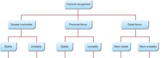 Illustration 9 for Mastering Fractures After Total Hip Arthroplasty