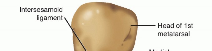 Metatarsophalangeal Joint Hemiarthroplasty: Get Pain Relief