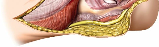 Illustration 24 for Mastering Elbow Approaches: Applied Surgical Anatomy for Precision