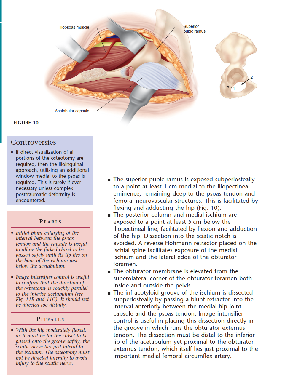 Illustration 24 for Bernese PAO: Unlocking the Procedure with Level V Evidence Insights