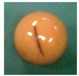 Illustration 21 for Which Bearing Surface Options Are Best for Your Total Hip?