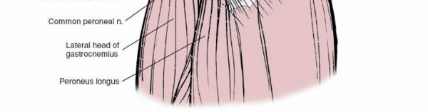 Illustration 166 for Mastering Knee Approaches: Spotlight on Superficial Medial Ligament