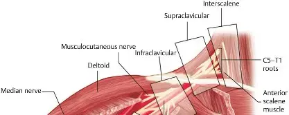 صورة توضيحية لـ إدارة الألم بعد جراحة الكتف: دليل شامل للمرضى مع الأستاذ الدكتور محمد هطيف